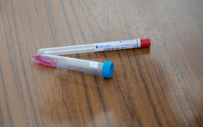 Mostres que s'analitzen al laboratori sobre Covid-19 | Roger Benet